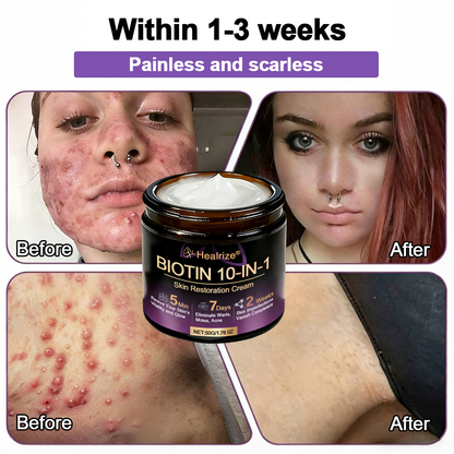 Made and Shipped from USA ✨𝐇e𝐚l𝐫i𝐳e® Biotin 10-in-1 Skin Restoration Cream 🍀