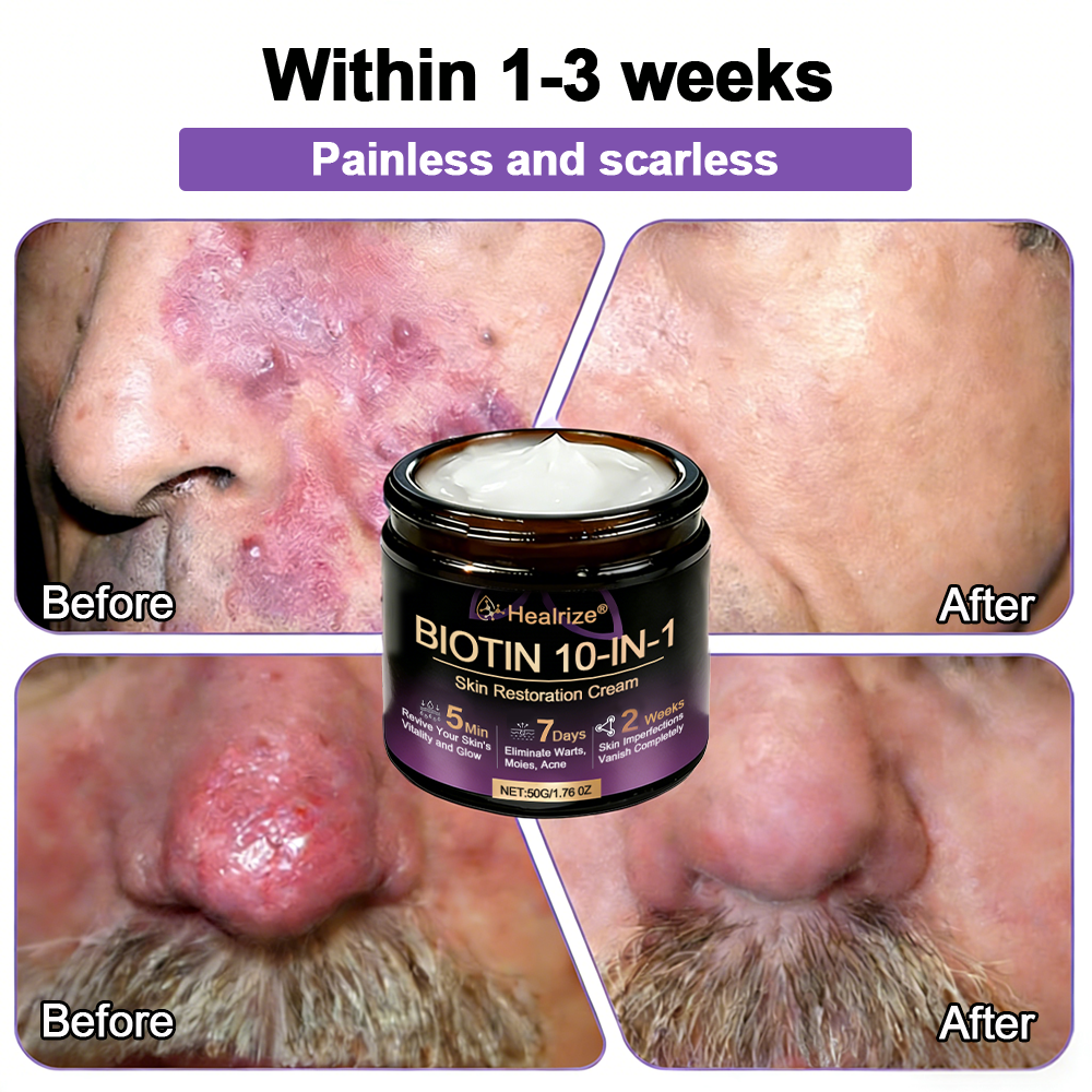 Made and Shipped from USA ✨𝐇e𝐚l𝐫i𝐳e® Biotin 10-in-1 Skin Restoration Cream 🍀