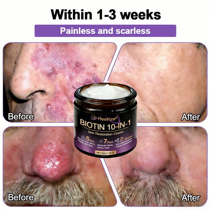Made and Shipped from USA ✨𝐇e𝐚l𝐫i𝐳e® Biotin 10-in-1 Skin Restoration Cream 🍀