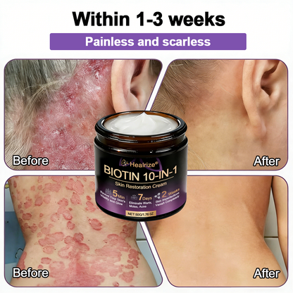 Made and Shipped from USA ✨𝐇e𝐚l𝐫i𝐳e® Biotin 10-in-1 Skin Restoration Cream 🍀