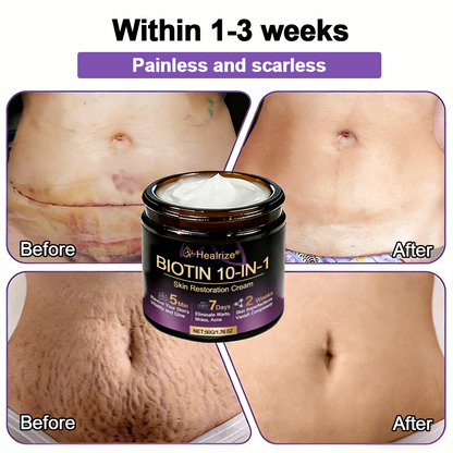Made and Shipped from USA ✨𝐇e𝐚l𝐫i𝐳e® Biotin 10-in-1 Skin Restoration Cream 🍀